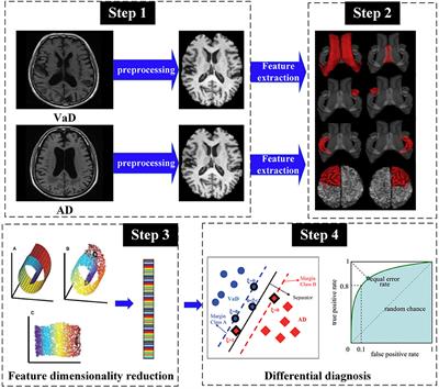 Machine Learning-Based Framework for Differential Diagnosis Between Vascular Dementia and Alzheimer's Disease Using Structural MRI Features